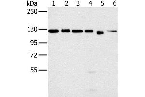Western Blot analysis of 293T, K562, hela, 231, Jurkat and NIH/3T3 cell using MATR3 Polyclonal Antibody at dilution of 1:500 (MATR3 anticorps)
