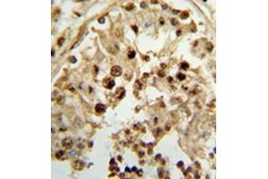 Immunohistochemistry analysis in formalin-fixed and paraffin-embedded human testis tissue reacted with 17-beta-HSD3 / HSD17B3 Antibody (Center) followed which was peroxidase conjugated to the secondary antibody, followed by DAB staining. (HSD17B3 anticorps  (Middle Region))