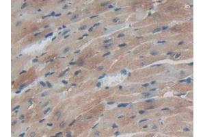 IHC-P analysis of Mouse Heart Tissue, with DAB staining. (TXNRD1 anticorps  (AA 374-577))