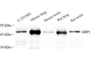 Western blot analysis of GRP1 (ABIN7073681) at dilution of 1: 250 (Cytohesin 3 anticorps)