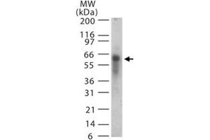 Western blot analysis of ASB3 in 15 ugs of human spleen lysate. (ASB3 anticorps  (AA 63-75))