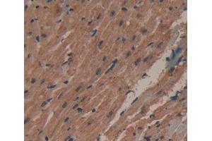 Used in DAB staining on fromalin fixed paraffin- embedded heart tissue