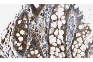 ABIN6278288 at 1/100 staining Rat colon tissue by IHC-P. (TMOD2 anticorps  (N-Term))