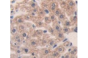 IHC-P analysis of Mouse Tissue, with DAB staining. (alpha 2 Macroglobulin anticorps  (AA 157-389))