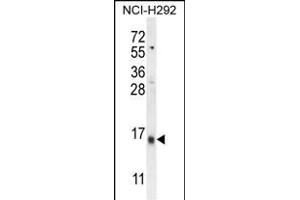 LY6G6C Antibody (C-term) (ABIN654496 and ABIN2844228) western blot analysis in NCI- cell line lysates (35 μg/lane). (LY6G6C anticorps  (C-Term))