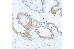 Immunohistochemistry of paraffin-embedded human breast using N antibody (ABIN6132387, ABIN6144378, ABIN6144379 and ABIN6216511) at dilution of 1:100 (40x lens).