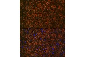 Immunofluorescence analysis of rat brain using Myelin oligodendrocyte glycoprotein Rabbit mAb (ABIN7268722) at dilution of 1:100 (40x lens). (MOG anticorps)