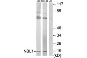 Western Blotting (WB) image for anti-Neuroblastoma 1, DAN Family BMP Antagonist (NBL1) (AA 131-180) antibody (ABIN2889475)