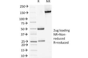 SDS-PAGE Analysis Purified DSG1 Mouse Monoclonal Antibody (18D4). (Desmoglein 1 anticorps)