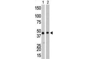 Western Blotting (WB) image for anti-Creatine Kinase, Brain (CKB) antibody (ABIN3002966) (CKB anticorps)