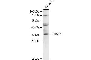 Western blot analysis of extracts of rat brain, using TH antibody (ABIN6133215, ABIN6149107, ABIN6149108 and ABIN6220276) at 1:3000 dilution. (THAP2 anticorps  (AA 83-228))
