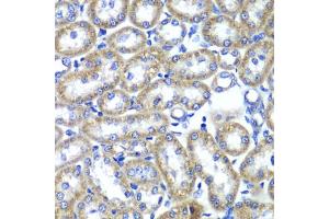 Immunohistochemistry of paraffin-embedded rat kidney using TMED10 Antibody. (TMED10 anticorps)