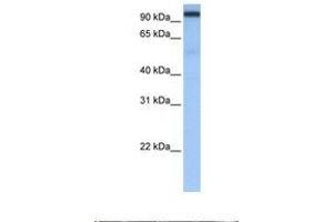 Image no. 1 for anti-Cleavage and Polyadenylation Specific Factor 2, 100kDa (CPSF2) (AA 73-122) antibody (ABIN6737956)