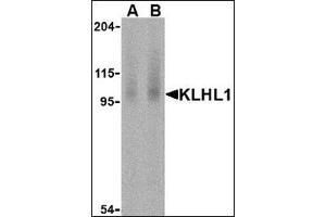 Western blot analysis of KLHL1 in human brain cell lysate with this product at (A) 2 and (B) 4 μg /ml. (KLHL1 anticorps  (N-Term))