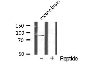 Western blot analysis of extracts from mouse brain, using CHSY1 antibody.