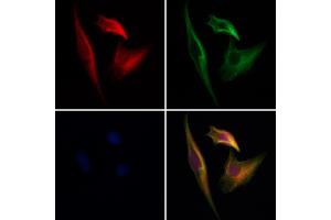 ABIN7094143 and ABIN7098187 staining Hela cells by IF/ICC. (CPNE6 anticorps  (Internal Region))