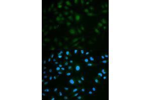 Immunofluorescence analysis of MCF7 cell using IL23R antibody. (IL23R anticorps)