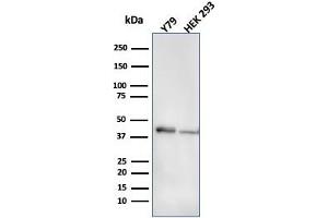 Western Blot Analysis of Y79 and HEK293 cell lysate using CKBB Mouse Monoclonal Antibody (CPTC-CKB-2). (CKB anticorps)