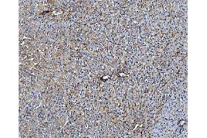 IHC analysis of TAPA1/CD81 using anti-TAPA1/CD81 antibody (ABIN5693258). (CD81 anticorps  (AA 116-201))