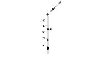 Anti-LGR5 Antibody (loop2) at 1:1000 dilution + Human skeletal muscle tissue lysate Lysates/proteins at 20 μg per lane. (LGR5 anticorps  (AA 689-719))