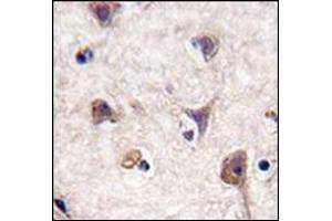 Formalin-fixed and paraffin-embedded human brain tissue reacted with Autophagy LC3 Antibody  followed which was peroxidase-conjugated to the secondary antibody, followed by DAB staining.