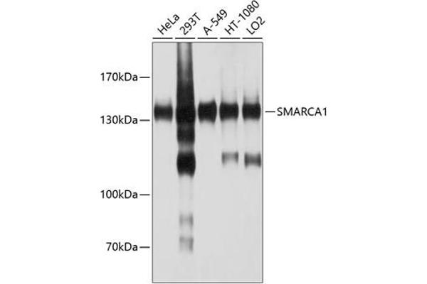 SMARCA1 anticorps  (AA 1-200)