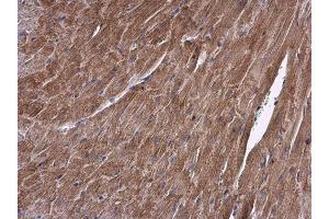IHC-P Image ALDH7A1 antibody detects ALDH7A1 protein at cytoplasm in mouse heart by immunohistochemical analysis. (ALDH7A1 anticorps)