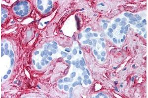 Human Breast (formalin-fixed, paraffin-embedded) stained with COL6A1 antibody ABIN214581 at 2. (COL6 anticorps)