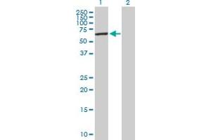 Western Blot analysis of ELP3 expression in transfected 293T cell line by ELP3 MaxPab polyclonal antibody.