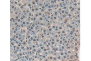 Used in DAB staining on fromalin fixed paraffin- embedded liver tissue