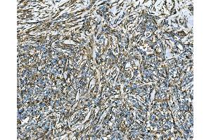 IHC analysis of RAB13 using anti-RAB13 antibody (ABIN7600599). (RAB13 anticorps  (AA 21-200))