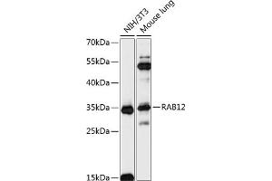 Western blot analysis of extracts of various cell lines, using R antibody (ABIN7269796) at 1:3000 dilution. (RAB12 anticorps  (AA 1-70))