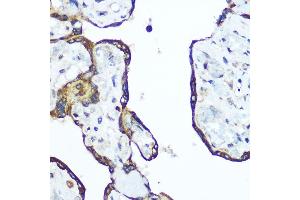 Immunohistochemistry of paraffin-embedded human placenta using RhoA Rabbit pAb (ABIN6134426, ABIN6146932, ABIN6146933 and ABIN6218128) at dilution of 1:100 (40x lens).