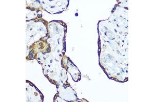 Immunohistochemistry of paraffin-embedded human placenta using RhoA Rabbit pAb (ABIN6134426, ABIN6146932, ABIN6146933 and ABIN6218128) at dilution of 1:100 (40x lens). (RHOA anticorps  (C-Term))