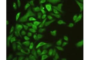 Detection of ICAM1 in Hela cells using Polyclonal Antibody to Intercellular Adhesion Molecule 1 (ICAM1)