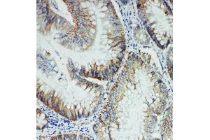 Anti-FER antibody, IHC(P) IHC(P): Rat Intestine Tissue