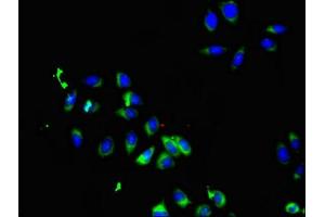 Immunofluorescent analysis of A549 cells using ABIN7169898 at dilution of 1:100 and Alexa Fluor 488-congugated AffiniPure Goat Anti-Rabbit IgG(H+L) (SMO anticorps  (AA 28-233))