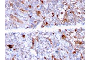 Formalin-fixed, paraffin-embedded human Kidney stained with C1QA Mouse Monoclonal Antibody (C1QA/2956). (C1QA anticorps  (AA 104-237))