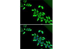 anti-CDK5 Regulatory Subunit Associated Protein 1-Like 1 (CDKAL1) (AA 1-230) antibody