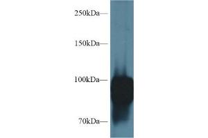 Western blot analysis of Rat Lung lysate, using Rat POSTN Antibody (1 µg/ml) and HRP-conjugated Goat Anti-Rabbit antibody ( (Periostin anticorps  (AA 659-810))