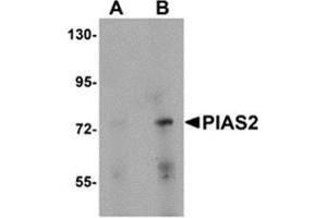 Western blot analysis of PIAS2 in rat brain tissue lysate with PIAS2 antibody at (A) 1 and (B) 2 μg/ml. (PIAS2 anticorps  (N-Term))