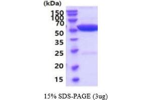 SDS-PAGE (SDS) image for Alanine Aminotransferase (ALT) (AA 1-496) (Active) protein (His tag) (ABIN6387974)