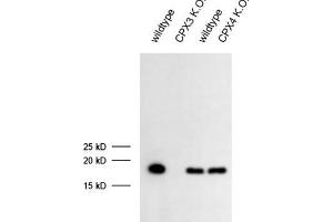 dilution: 1 : 1000 (ECL), sample: mouse retina extract (CPLX3 anticorps)