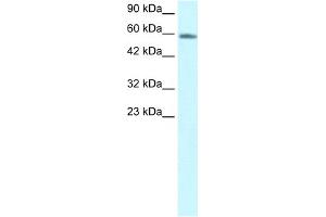 WB Suggested Anti-CHES1 Antibody Titration:  1. (FOXN3 anticorps  (C-Term))
