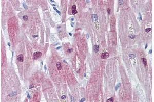 Human Heart: Formalin-Fixed, Paraffin-Embedded (FFPE)
