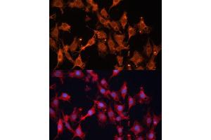 Immunofluorescence analysis of C6 cells using HSD17B1 Polyclonal Antibody (ABIN6129829, ABIN6142002, ABIN6142003 and ABIN6215013) at dilution of 1:100 (40x lens). (HSD17B1 anticorps  (AA 1-328))