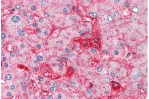 Human Liver (formalin-fixed, paraffin-embedded) stained with B2M antibody ABIN305901 at 5 ug/ml followed by biotinylated anti-mouse IgG secondary antibody ABIN481714, alkaline phosphatase-streptavidin and chromogen. (beta-2 Microglobulin anticorps)