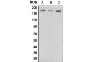 Western blot analysis of MRP3 expression in HepG2 (A), MCF7 (B), MDAMB435 (C) whole cell lysates. (ABCC3 anticorps  (Center))
