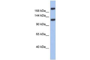 WB Suggested Anti-CACNA1I Antibody Titration: 0. (CACNA1I anticorps  (Middle Region))