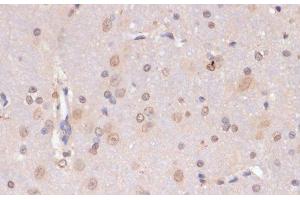 Immunohistochemistry of paraffin-embedded Rat brain using PIDD Polyclonal Antibody at dilution of 1:100 (40x lens). (PIDD anticorps)